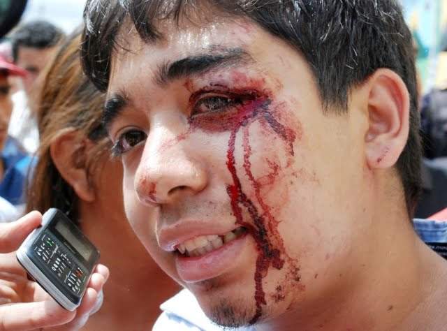 Hundredvis af demonstranter er såret i Honduras.