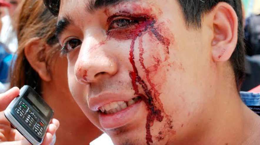 Kup i HondurasMange modstandere af kuppet i Honduras anerkender ikke landets nye præsident. ((Foto: Privatperson i Honduras).)