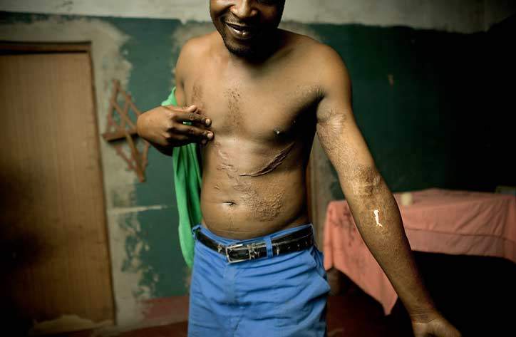 Tonecas overlevede en slem arbejdsulykke. Siden kom der fokus på sikkerheden. (Foto: Søren Zeuth)