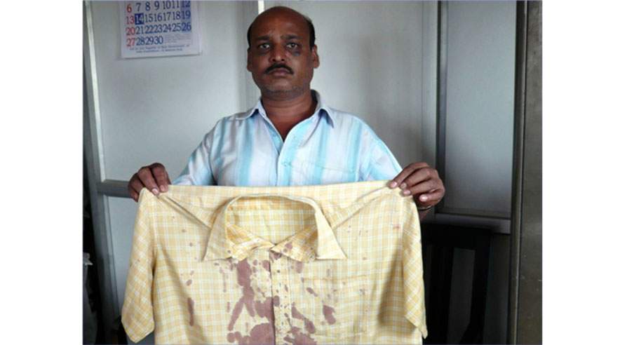 Indisk chauffør med sin blodige skjorte efter et af de overfald som arbejderne på Mærsks terminal har været udsat. Det er et af de overfald Gayatri Singh har undersøgt. (Foto: ITF.)
