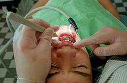 Tandlæger og andreliberale erhverv skal også omfattes af et forbud mod eksklusivaftaler, mener Dansk Folkeparti.  (Arkivfoto: Scanpix)